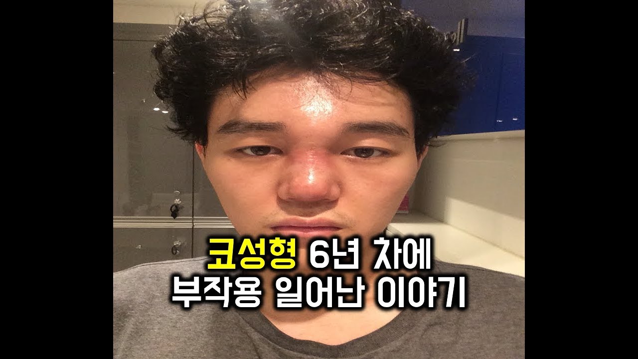 [혼술] 01화 코성형 6년 차에 부작용 일어난 이야기