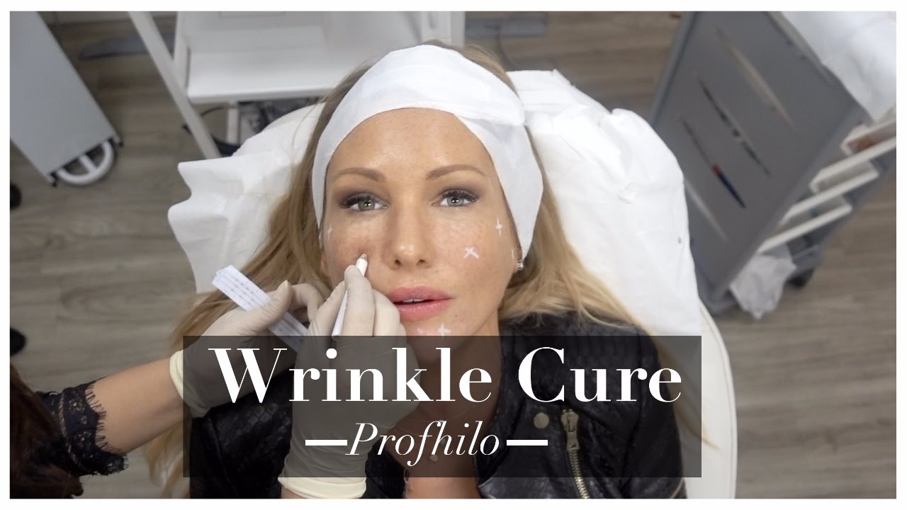 My Anti-Ageing Skin Care Beauty Treatment for Younger Looking Skin PROFHILO  | ADELA KING