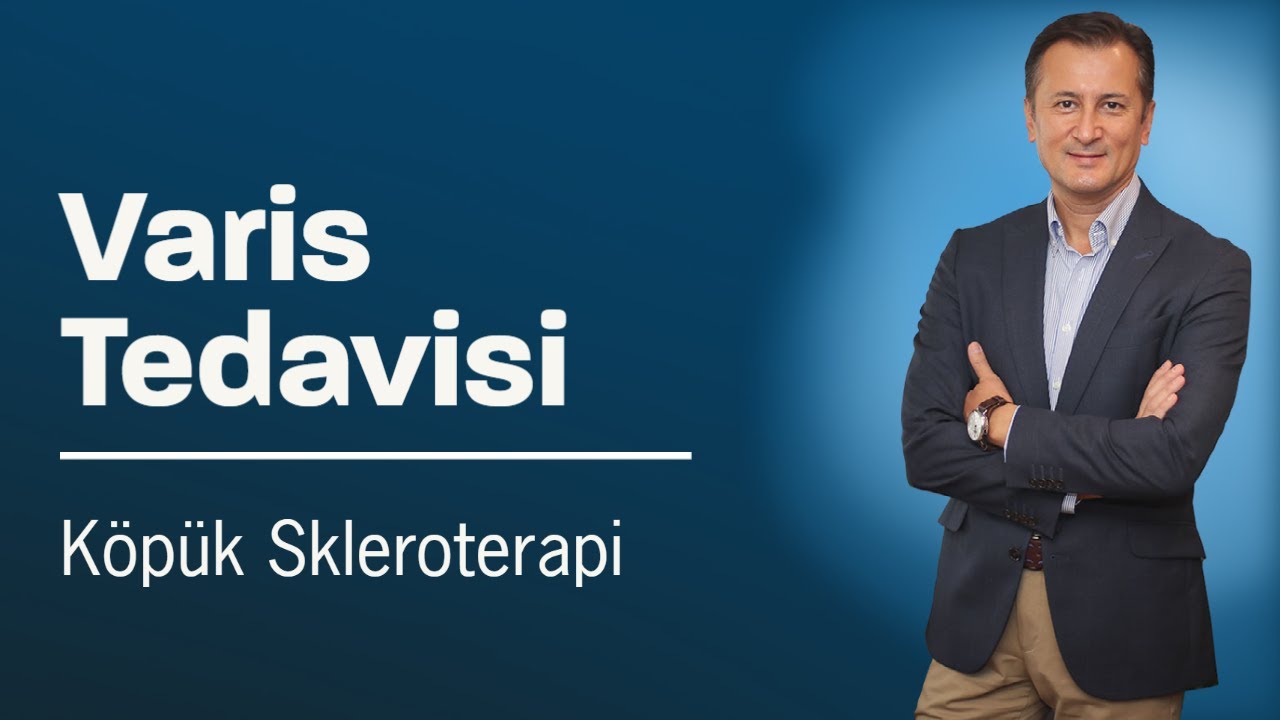 Varis Köpük Tedavisi (Skleroterapi) Nasıl Uygulanır? - Doç. Dr. İlker Kiriş