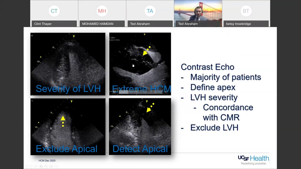 1/22/2021:De-Hyping Hypertrophic Cardiomyopathy (HCM)– Pushing Designer Drugs & Ditching the Scalpel