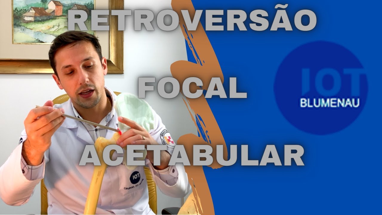 Retroversão Focal Acetabular