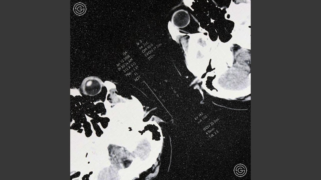 bp-ii