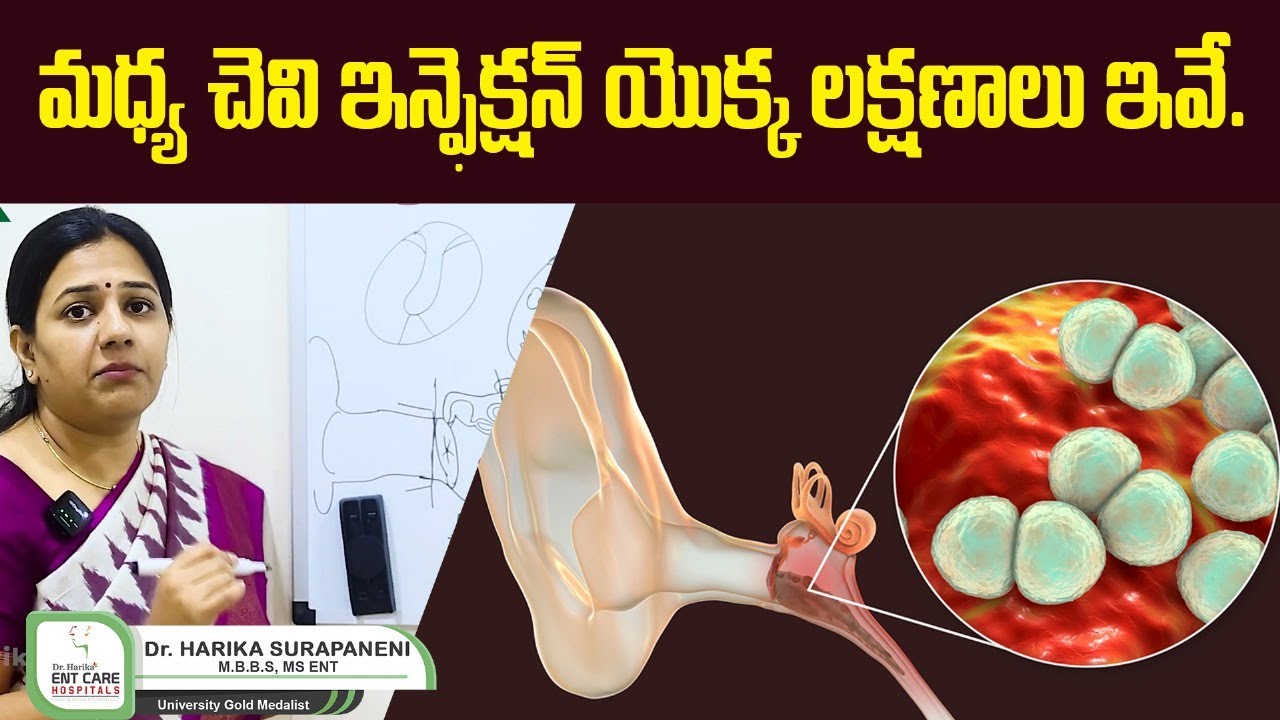 Middle Ear Infections || Otitismedia Infection in Telugu || Dr Harika ENT Care Hospital