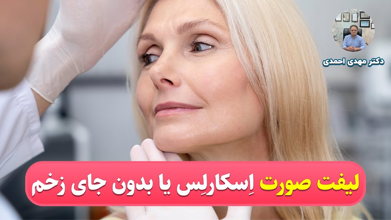 لیفت اِسکارلِس؛ بهترین و پیچیده‌ترین عمل لیفت صورت در دنیا