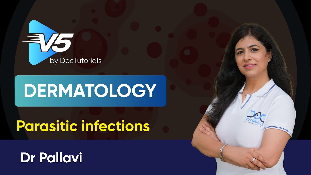 Parasitic Skin Infections for FMGE | Scabies, Pediculosis, Larva Migrans|Dermatology V5 DocTutorials