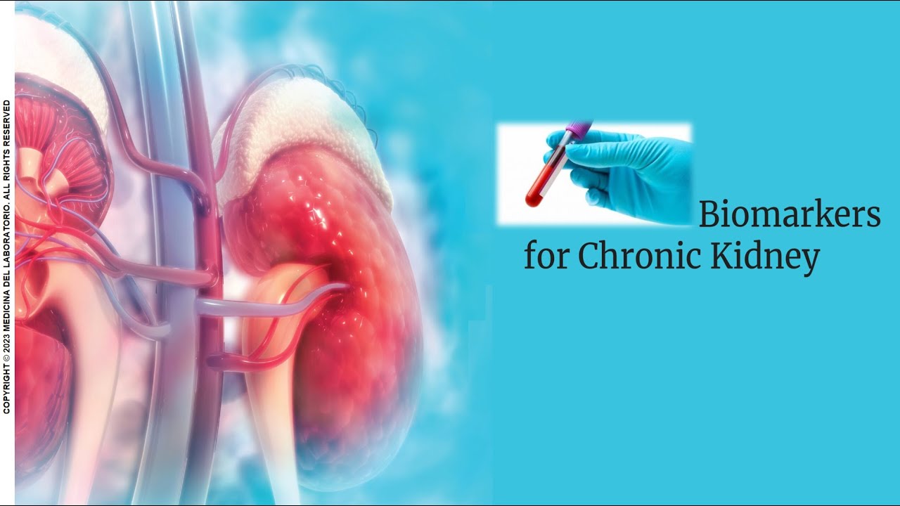 El correcto PERFIL RENAL para el diagnóstico de la enfermedad renal crónica. Luis Figueroa Montes