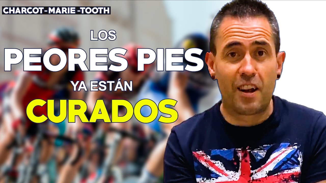 CHARCOT-MARIE-TOOTH: Los peores pies que hemos curado