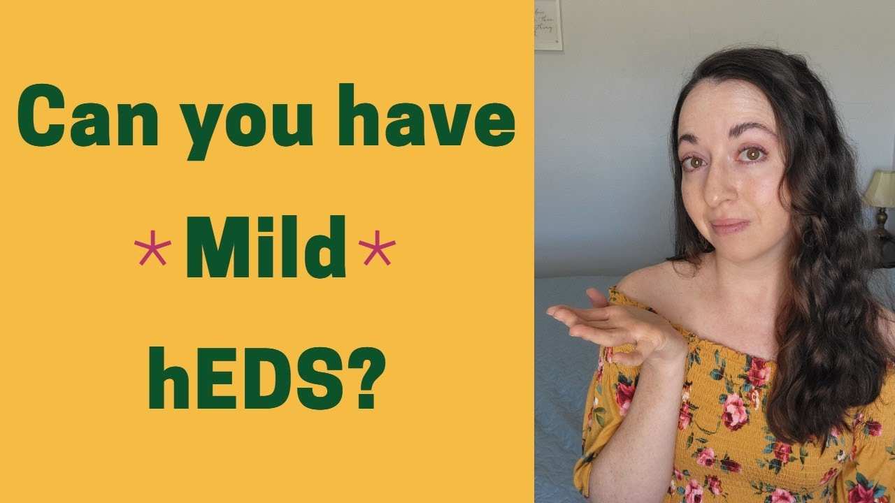Can you have Mild hEDS?