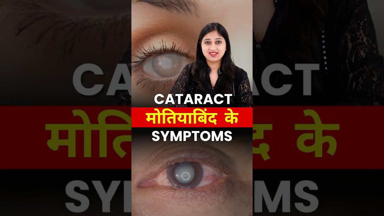 Cataract (Motiyabind) Ke Common Symptoms Kya Hai?