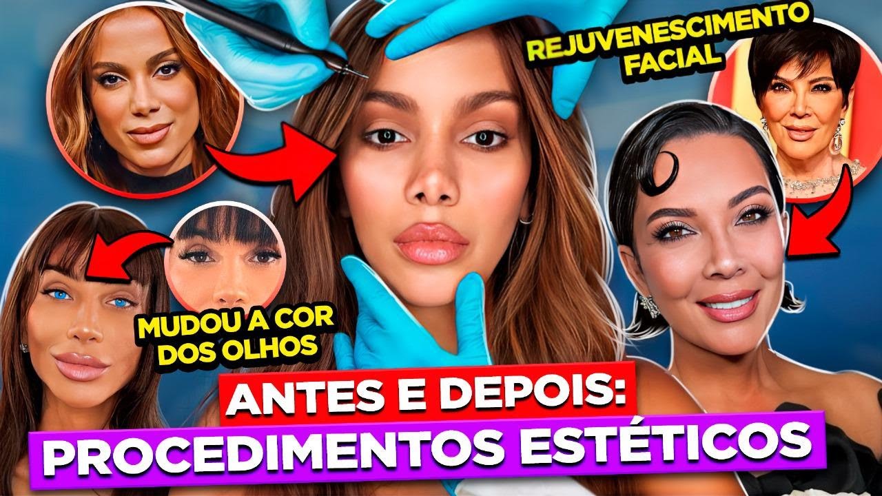 VALE TUDO PELA BELEZA? FAMOSAS ANTES E DEPOIS DAS PLÁSTICAS | Diva Depressão