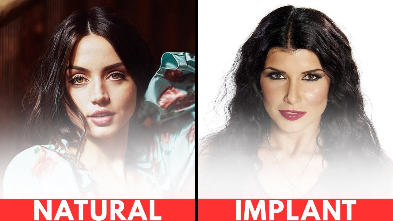 BIG B**BS LOVE STARS NATURAL VS IMPLANT