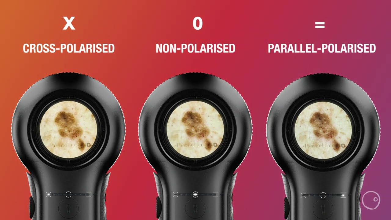 DermLite DL5 Dermatoscope | The perfect solution to all your dermoscopy needs