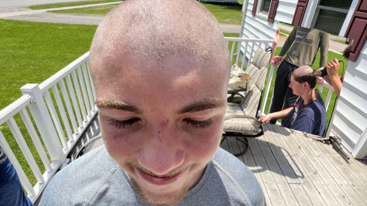 I Went Bald!😱