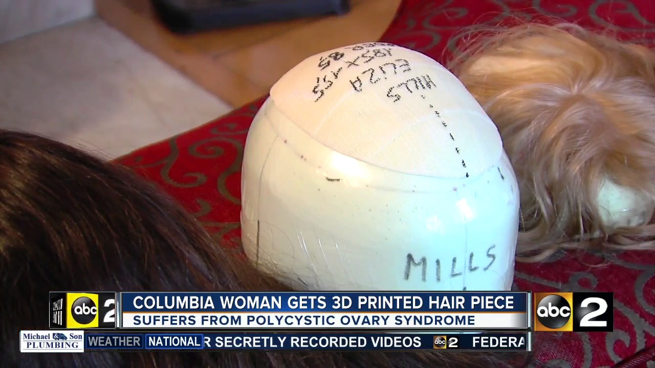 Columbia woman gets 3D printed hair piece