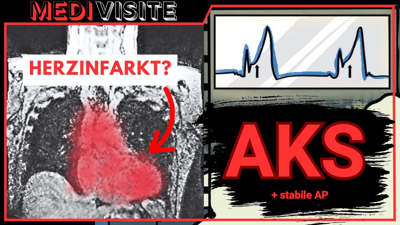 Kardiologie in unter 9min (STEMI/NSTEMI, Aortendissektion, Symptome & mehr)