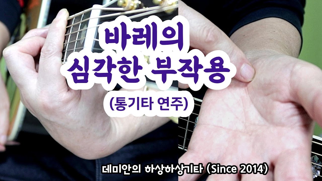 (통기타)바레 자주 쓰면 손 망가진다 ! /데미안의 하상하상기타