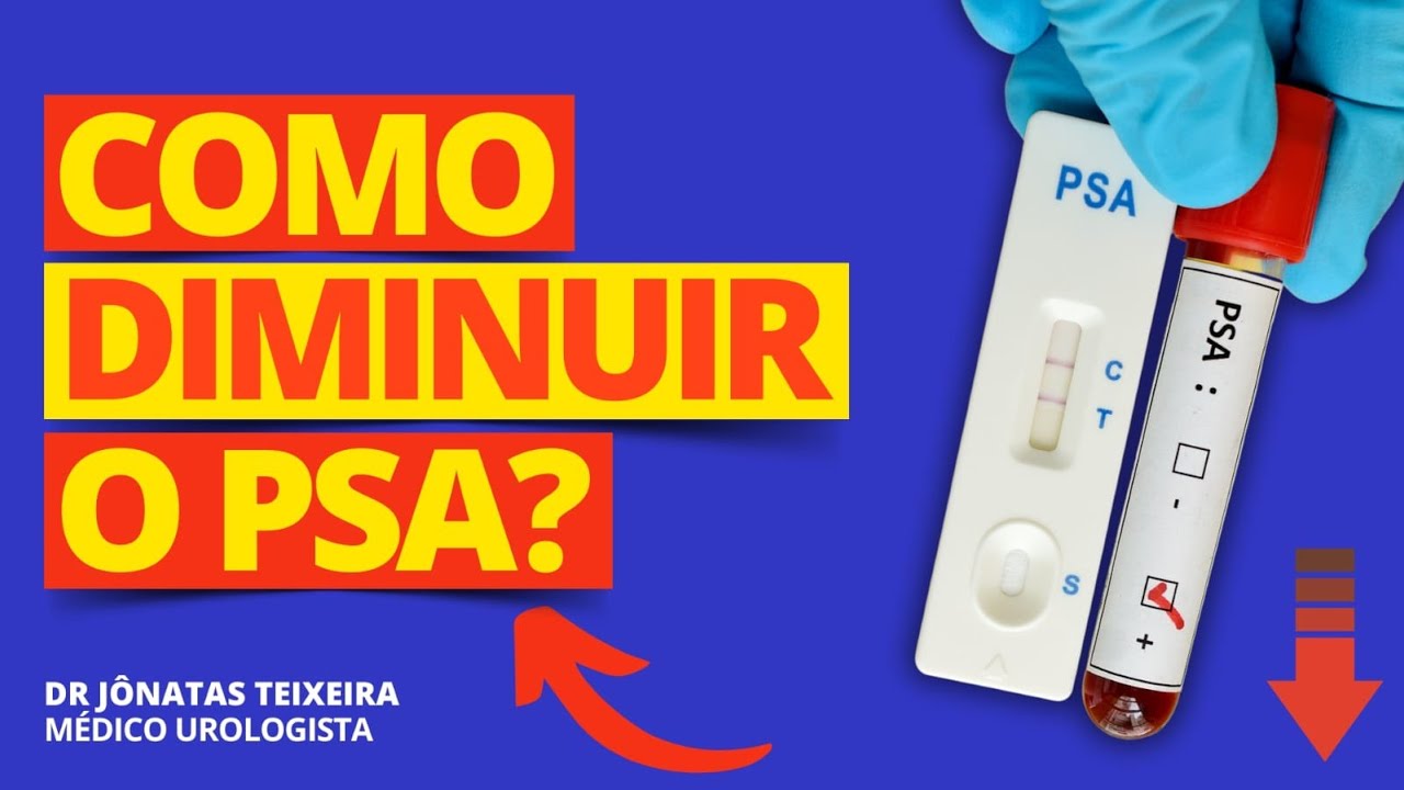 COMO REDUZIR O PSA? UROLOGISTA RESPONDE