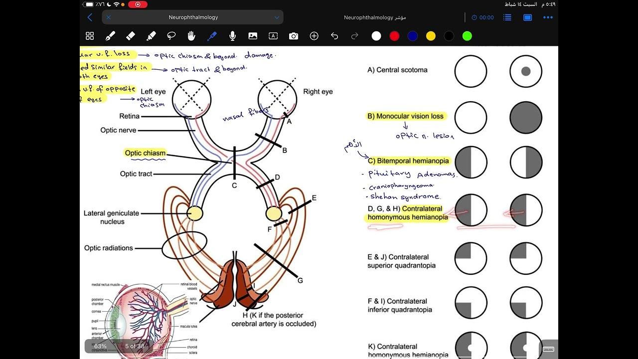 Ophthalmology / Neurophthalmology part 1