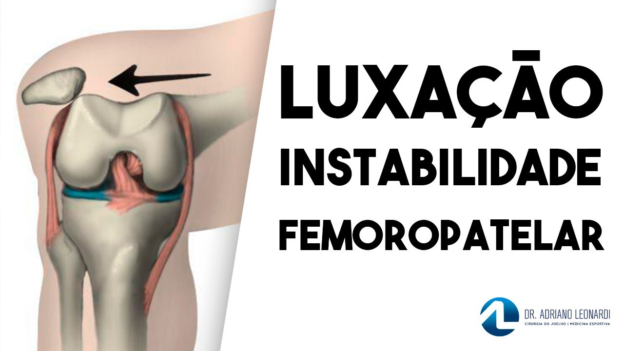 LUXAÇÃO E INSTABILIDADE FEMOROPATELAR