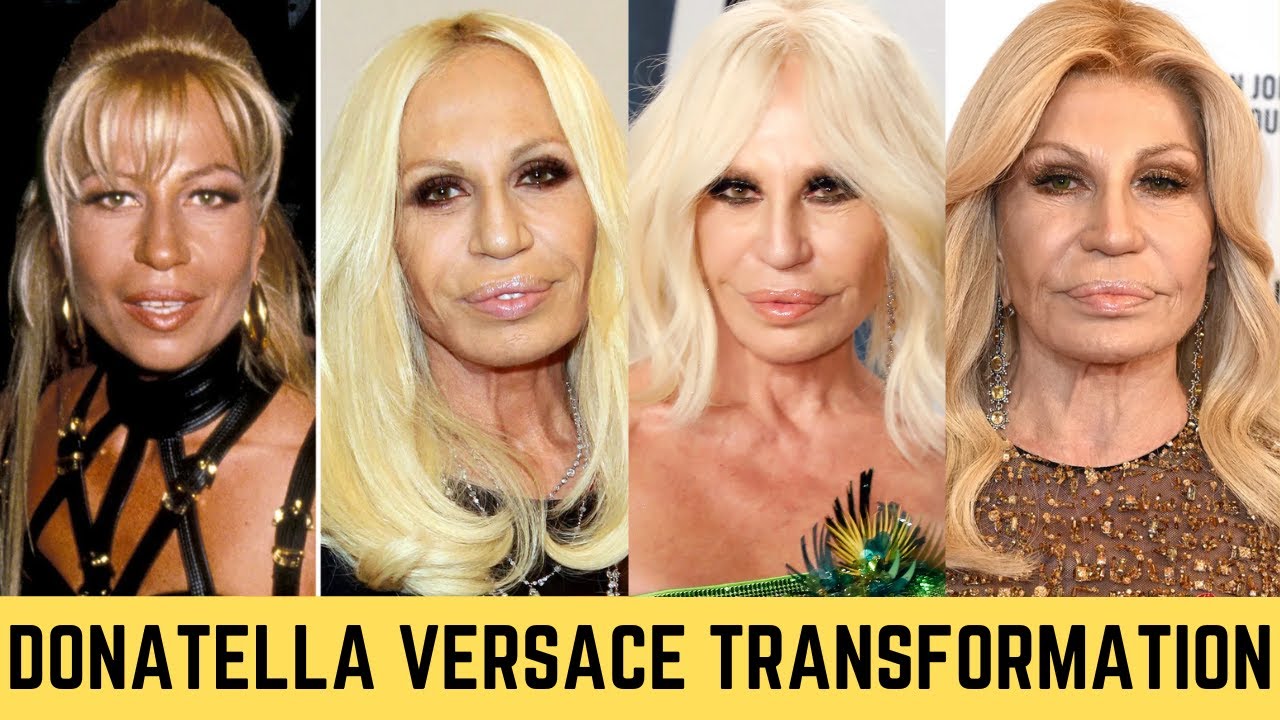 Donatella Versace - NEW DRAMATIC FACE CHANGE 2024