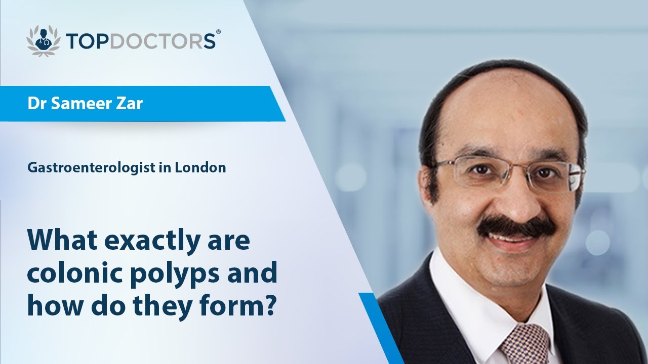 What exactly are colonic polyps and how do they form? - Online interview