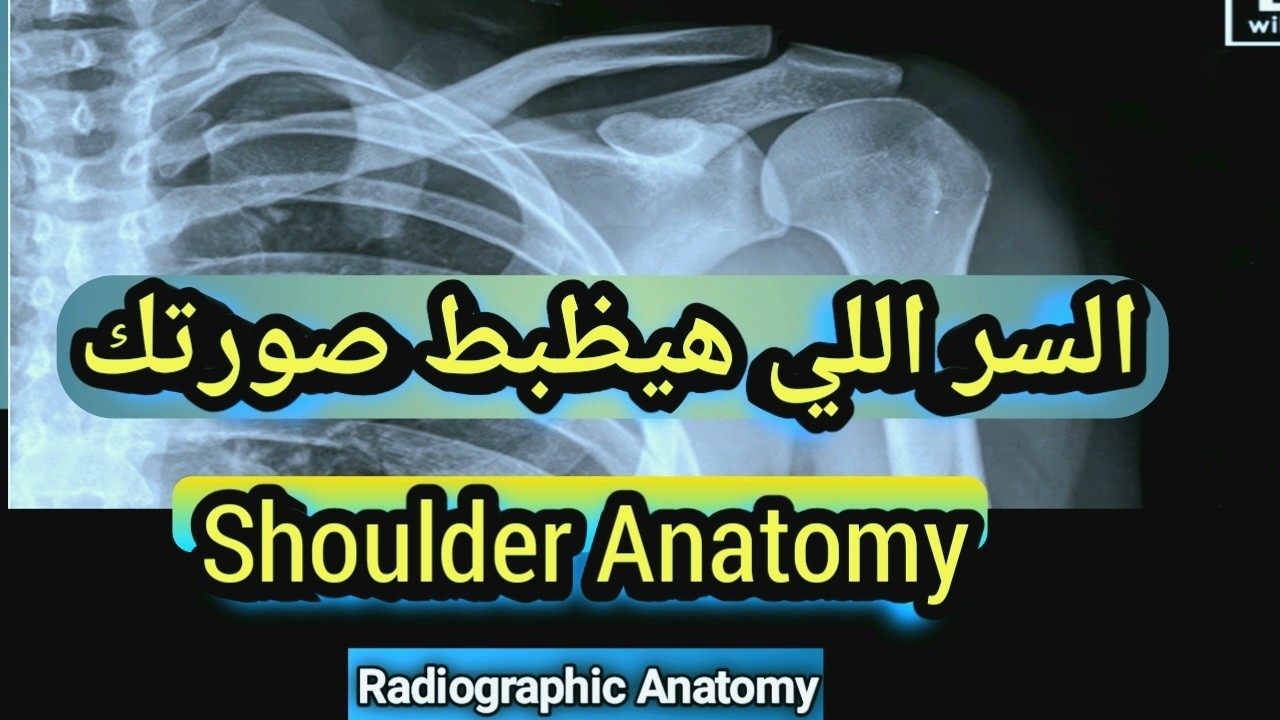 مينفعش تصوّر Shoulder قبل ما تشوف الفيديو ده! | X-Ray Anatomy of Shoulder
