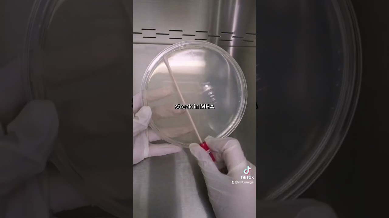 Antibiotics for Urinary Tract Infection. Anti-microbial Susceptibility Testing # 