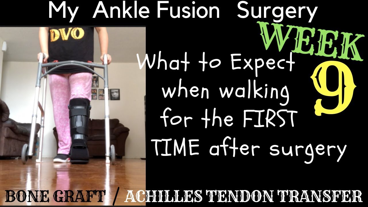 Learning to walk after Ankle Surgery
