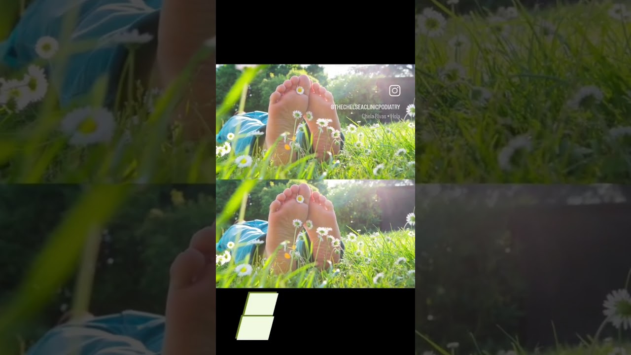 Summer Heat, Summer Feet! Here are some common foot problems during hot season ☀