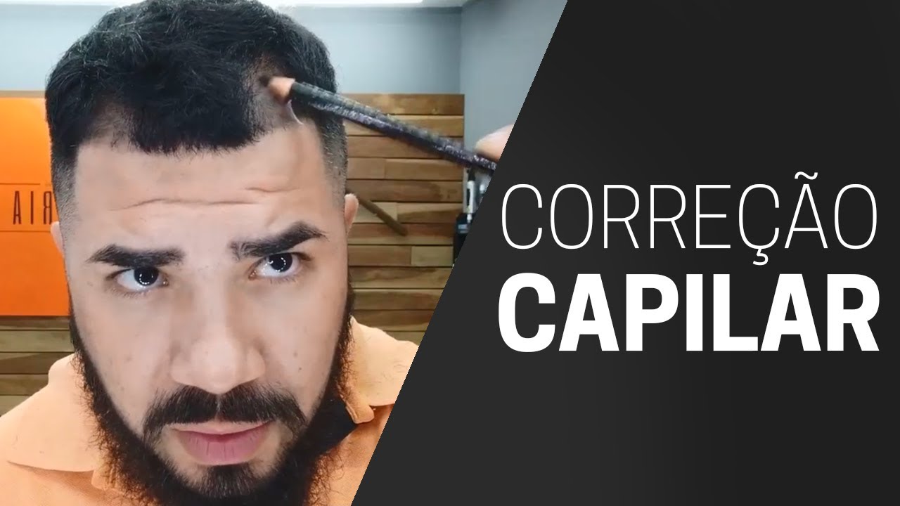 Como Disfarçar A Calvície Rapidamente com Lápis Dermatográfico Tutorial Prático e fácil.