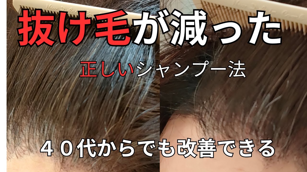 最近、分け目が気になり始めた40代女性へ｜洗い方を変えたら髪が変わり始めました/品川区中延美容院Pensiero【ペンシエロ】