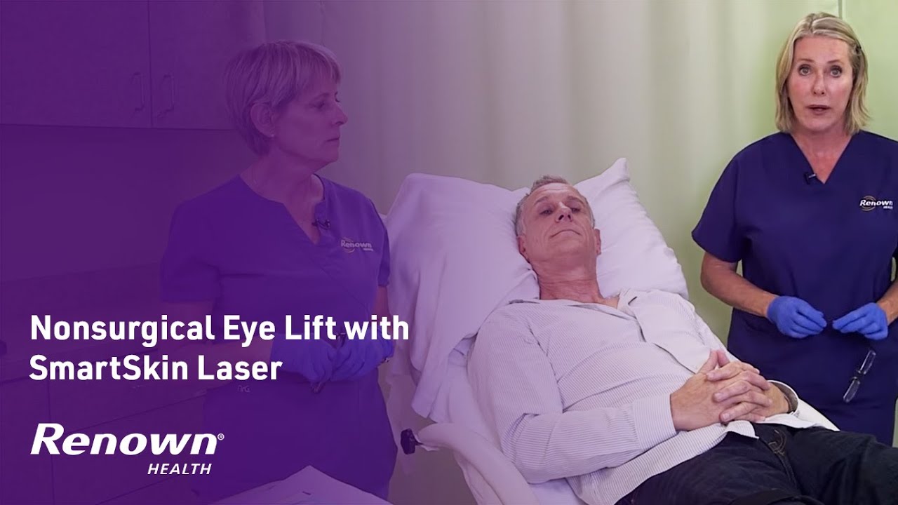 Nonsurgical Eye Lift with SmartSkin Laser