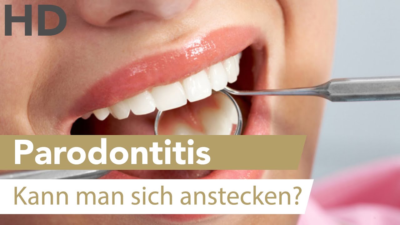 Was DU bei Parodontitis tun kannst