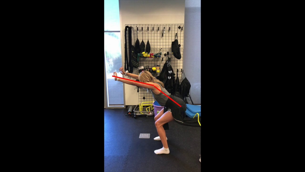 Pronation Distortion Syndrome