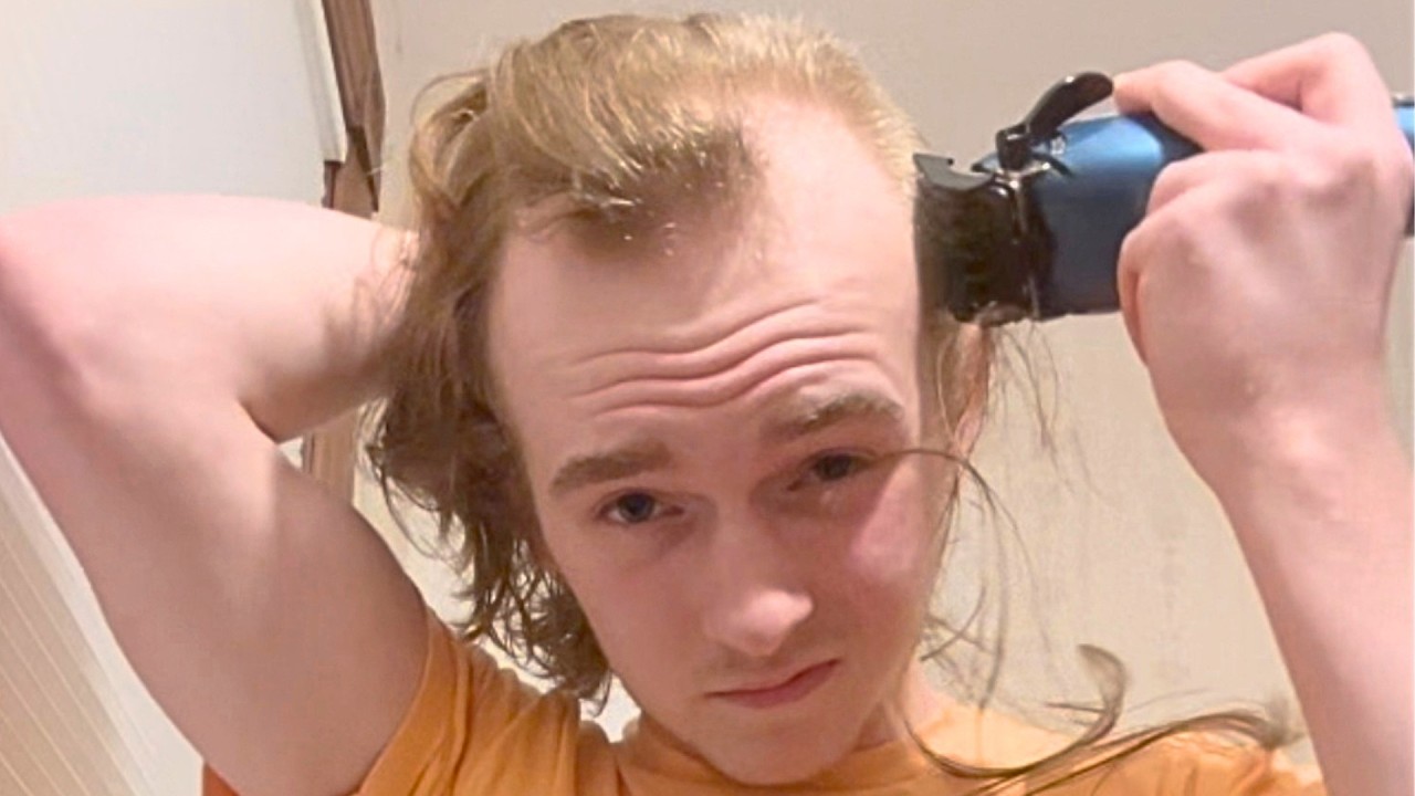 BALDING At 14 & Shaving My Head Completely Bald