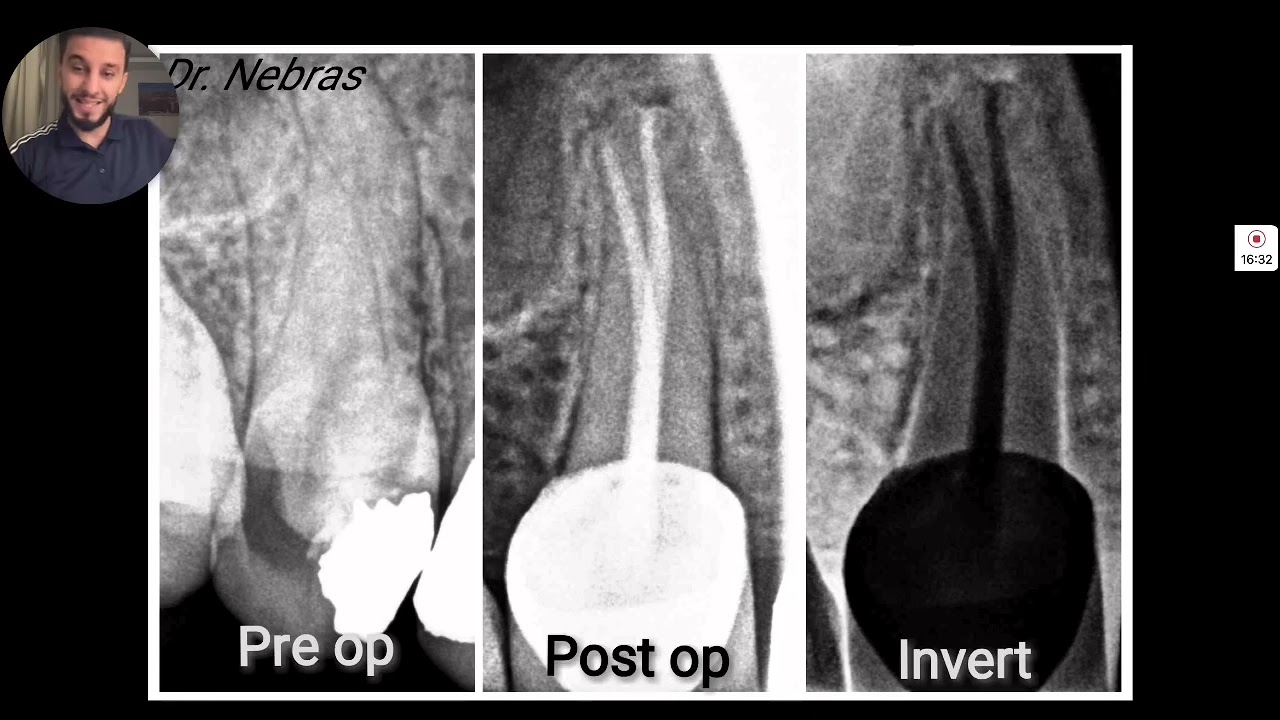 نصف ساعة #للX_RAY .. بإذن الله تفرق معاك 👌د. نبراس الدهاش - Dr. Nebras aldahash