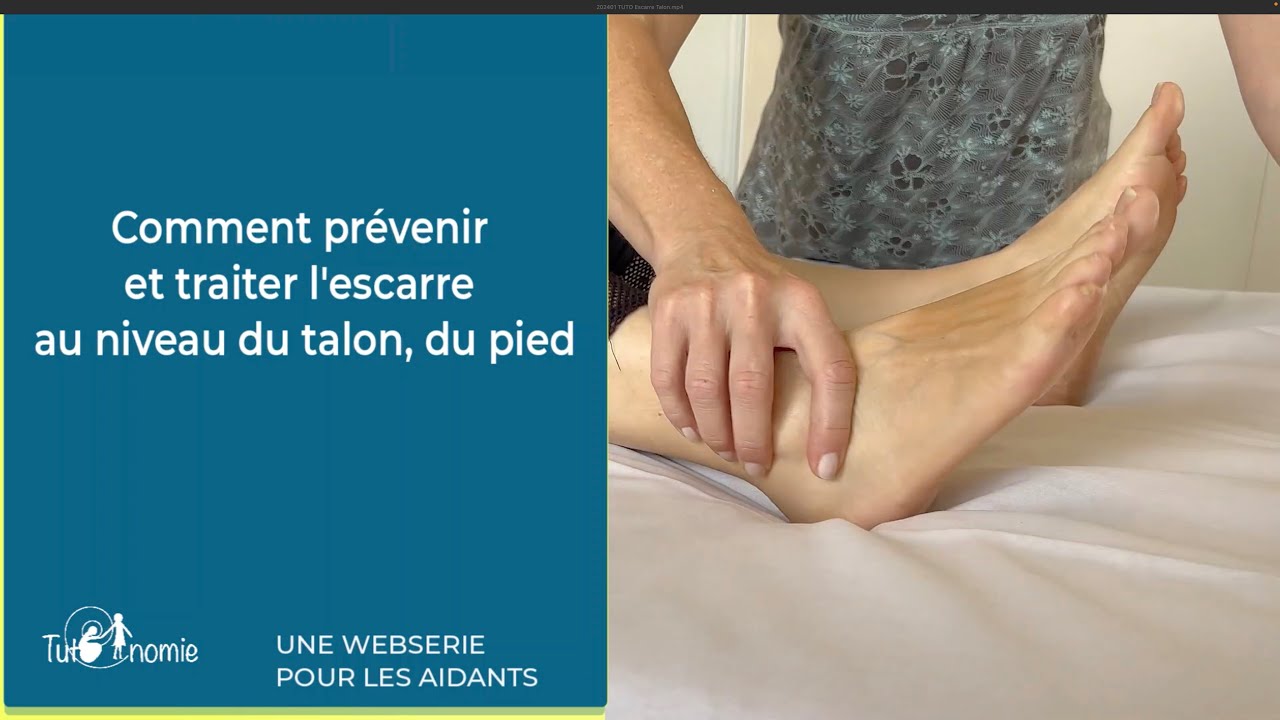 Comment prévenir et traiter l’escarre au niveau des talons ou du pied? Tutoriel