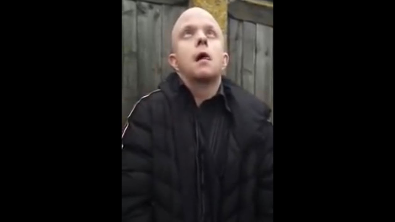 Bald nonce full sting