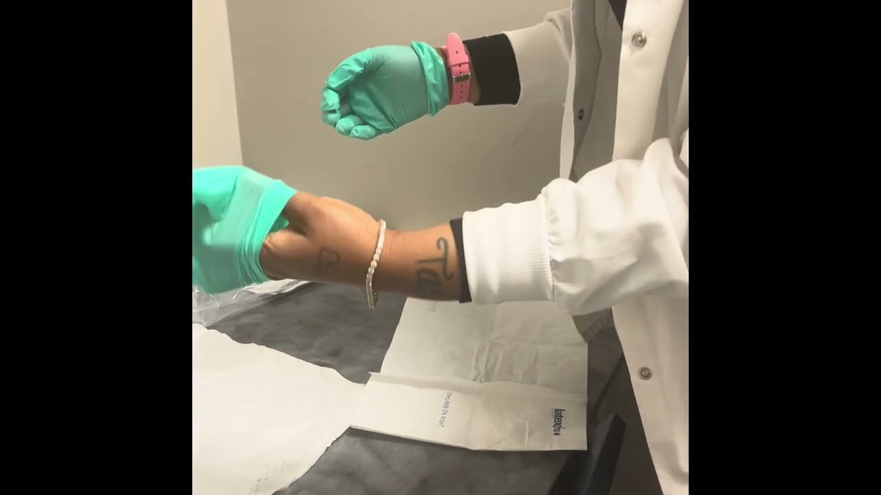 Inserting an indwelling catheter 