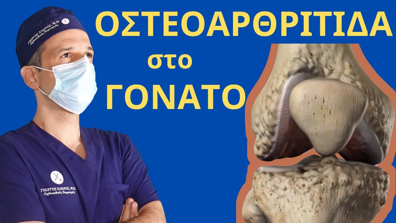 &Tau;&iota; &epsilon;ί&nu;&alpha;&iota; &eta; &Omicron;&sigma;&tau;&epsilon;&omicron;&alpha;&rho;&theta;&rho;ί&tau;&iota;&delta;&alpha; &Gamma;ό&nu;&alpha;&tau;&omicron;&sigmaf;; &Mu;ά&theta;&epsilon;&tau;&epsilon; &sigma;&epsilon; 2 &lambda;&epsilon;&pi;&tau;ά! #orthopaidikos