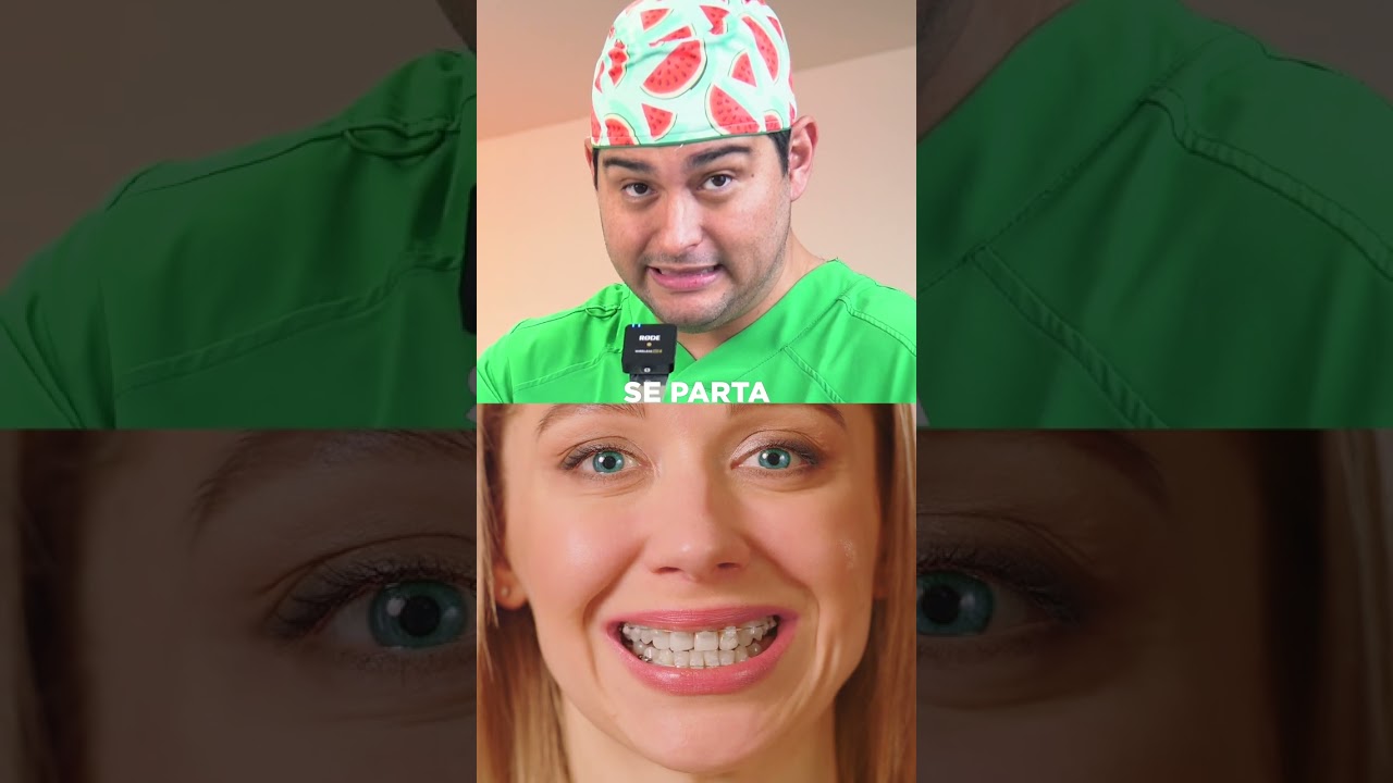 &iquest;BRACKETS MET&Aacute;LICOS O EST&Eacute;TICOS? 🤔