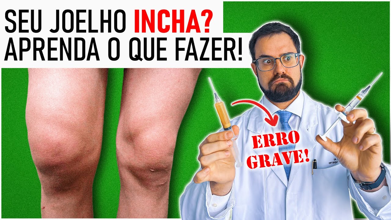Água no Joelho: As Principais CAUSAS e TRATAMENTOS para o Derrame Articular [Aula Completa]