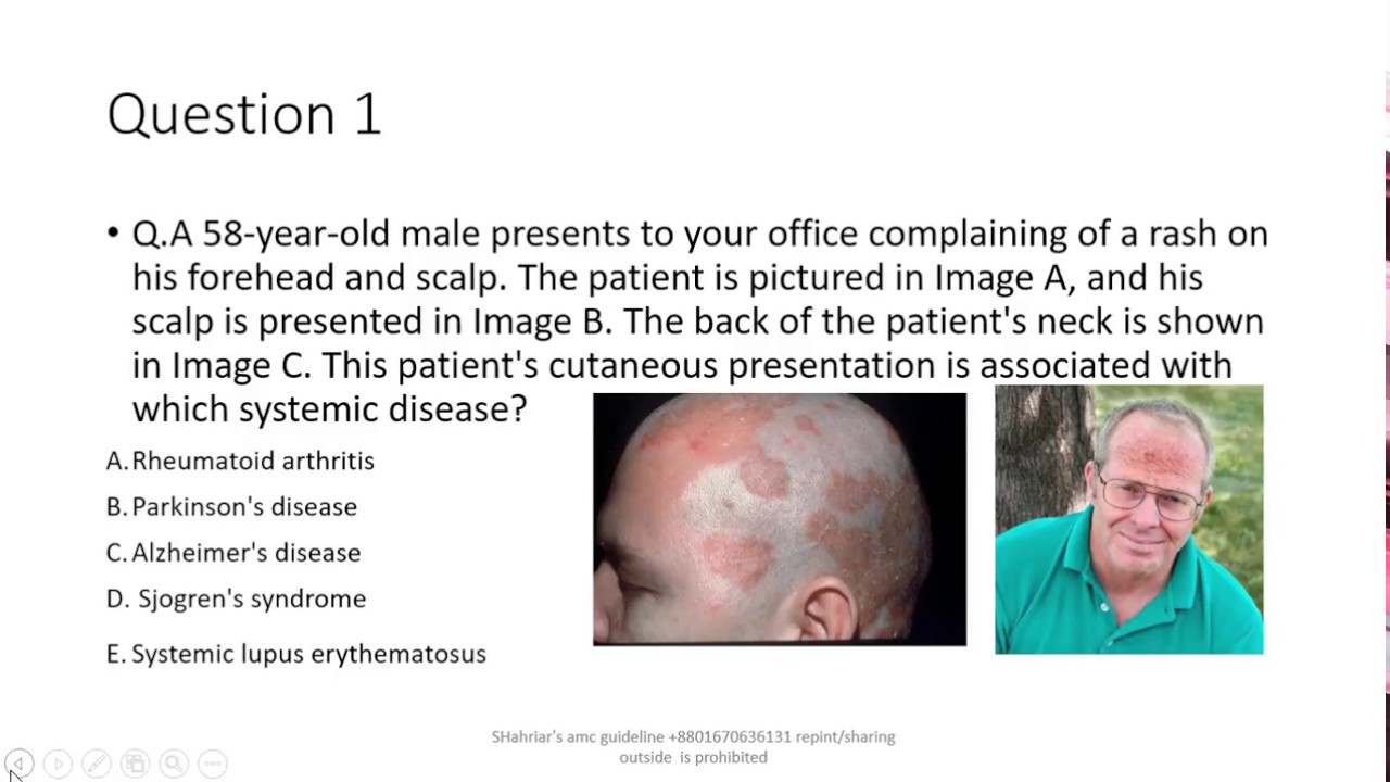 AMC MCQdermatology Q & A