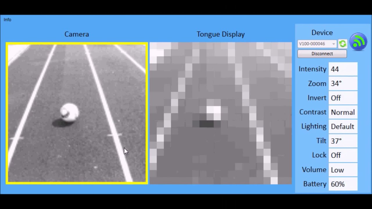 brainPort action video