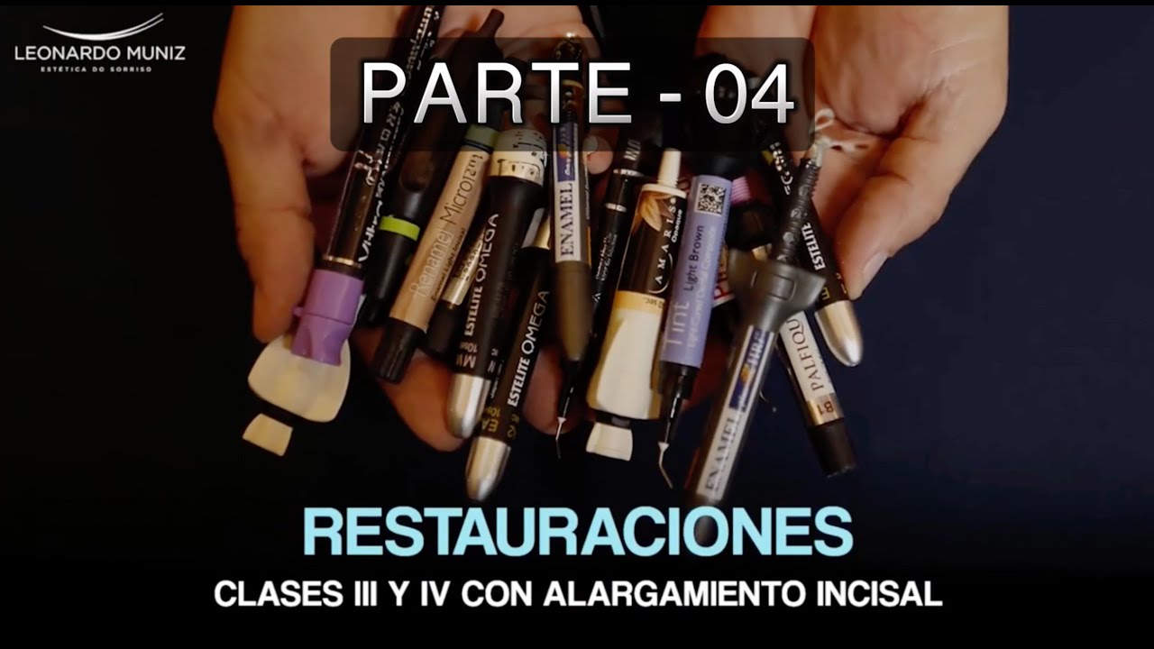 Restauraciones Clase III y IV con Alargamiento Incisal - Parte 4
