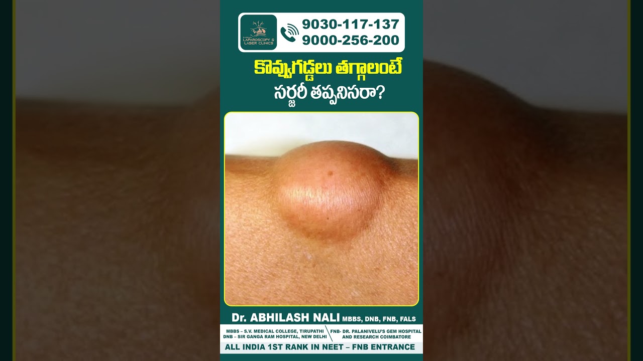 Lipoma Treatment in Telugu | Dr Abhilash Nali | #lipomacauses #shorts #ytshorts #healthtipsintelugu