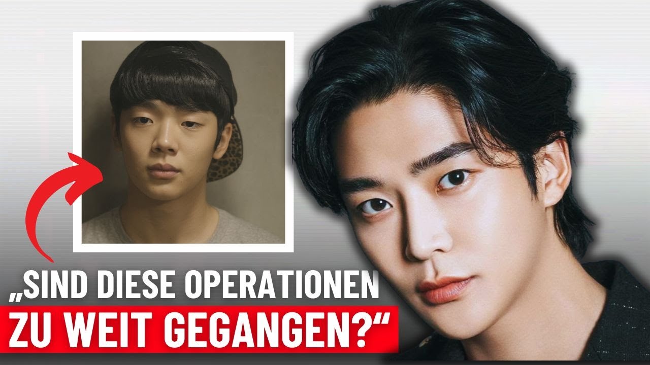 Die EXTREMSTEN  Schönheitsoperationen in der Geschichte der K-Dramen