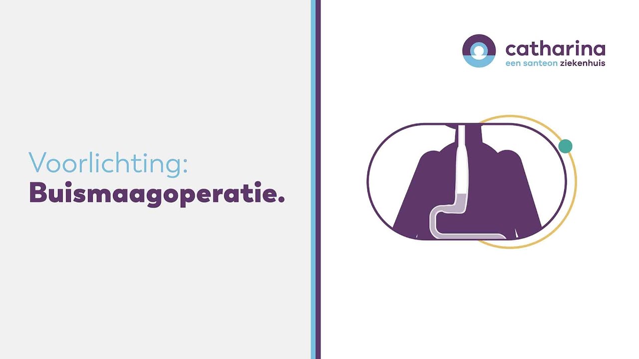 Een buismaagoperatie, hoe gaat dat? | Slokdarmkanker