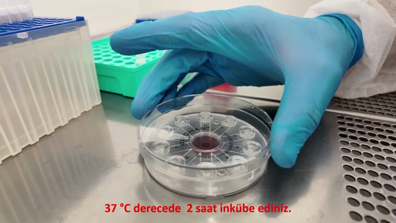 toROMAN MİKRO AKIŞKAN SPERM AYIKLAMA ÇİPİNİN MİKROPİPET İLE KULLANIM VİDEOSU