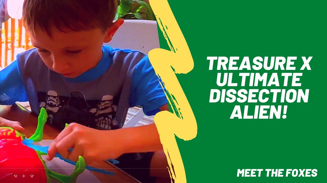 Treasure X Ultimate Dissection Alien!